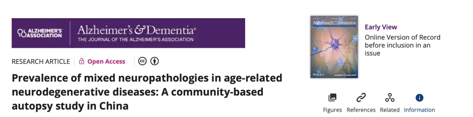 揭示大脑衰老内幕，50岁前尤其留意这种情况出现