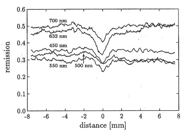 为什么有的人手上青筋暴起？这些地方出现青筋，一定要小心