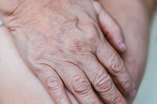 为什么有的人手上青筋暴起？这些地方出现青筋，一定要小心