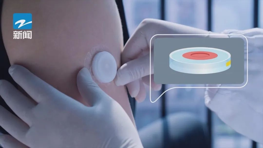 不可思议！挂盐水实现了无痛、“无线”