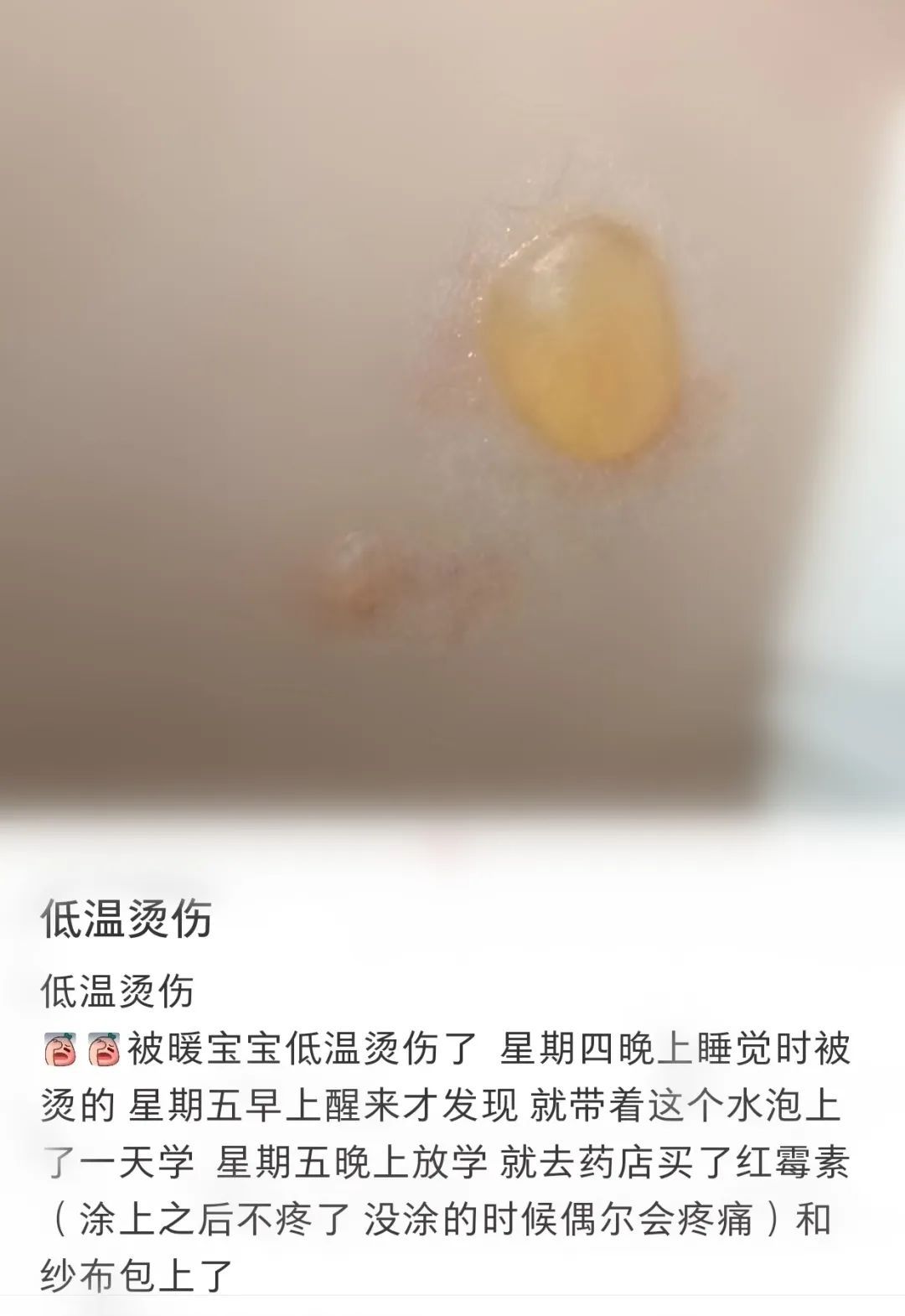 进入高发期！警惕温暖“陷阱”，很多人家里都有…