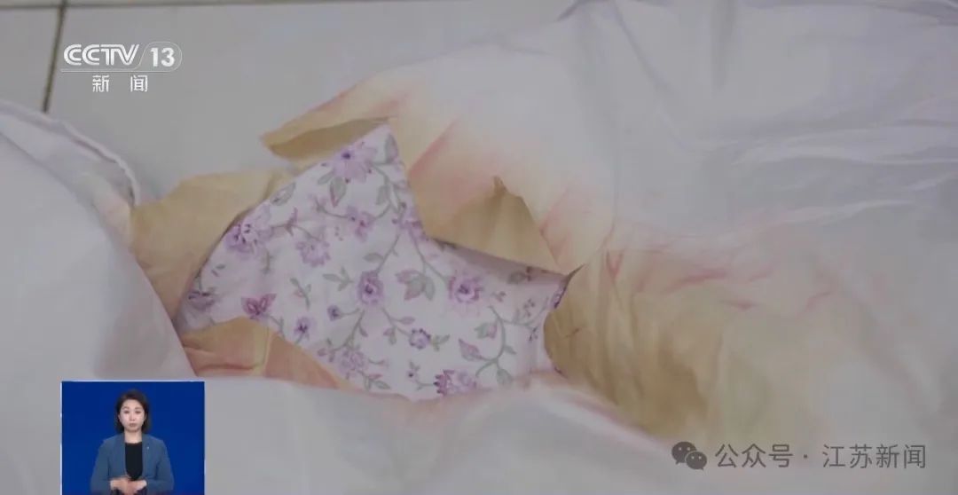 一觉醒来，12岁女儿腿部造成三级烫伤，只因妈妈用了这个……