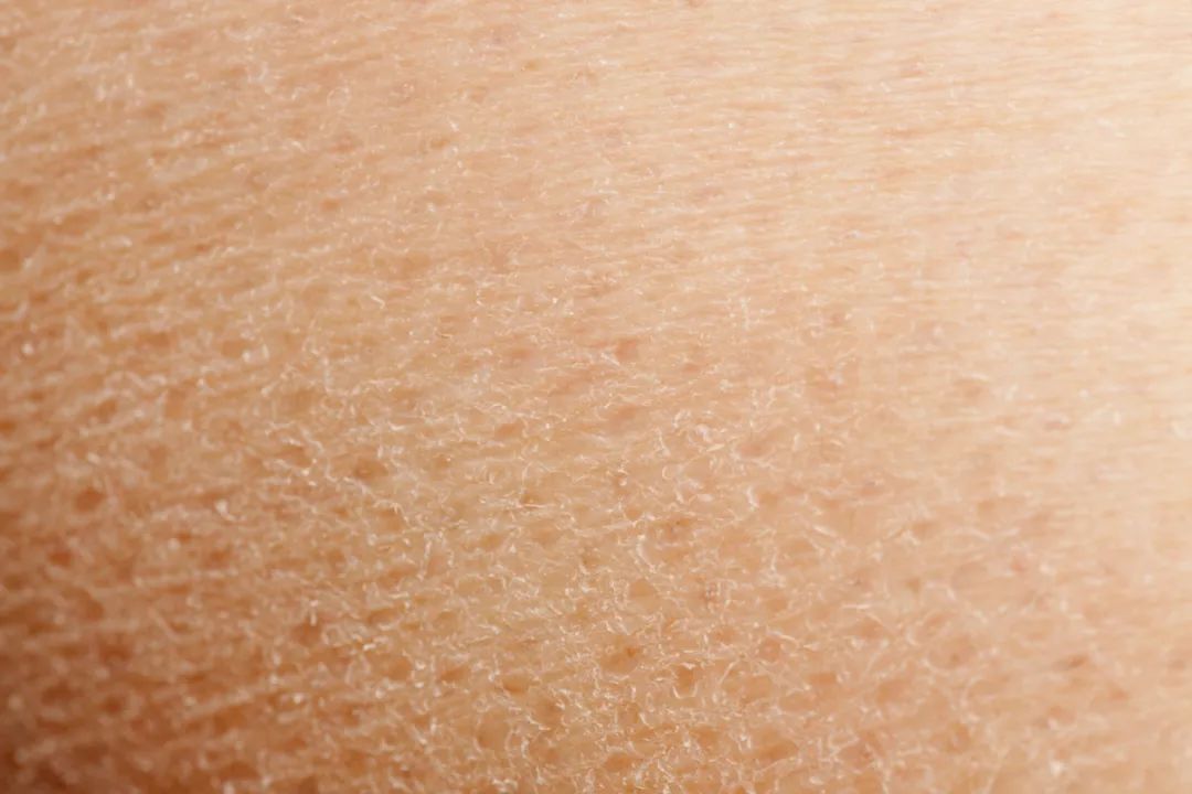 痒！痒！痒！最近重庆很多人直呼太难受，网友：痒得停不下来