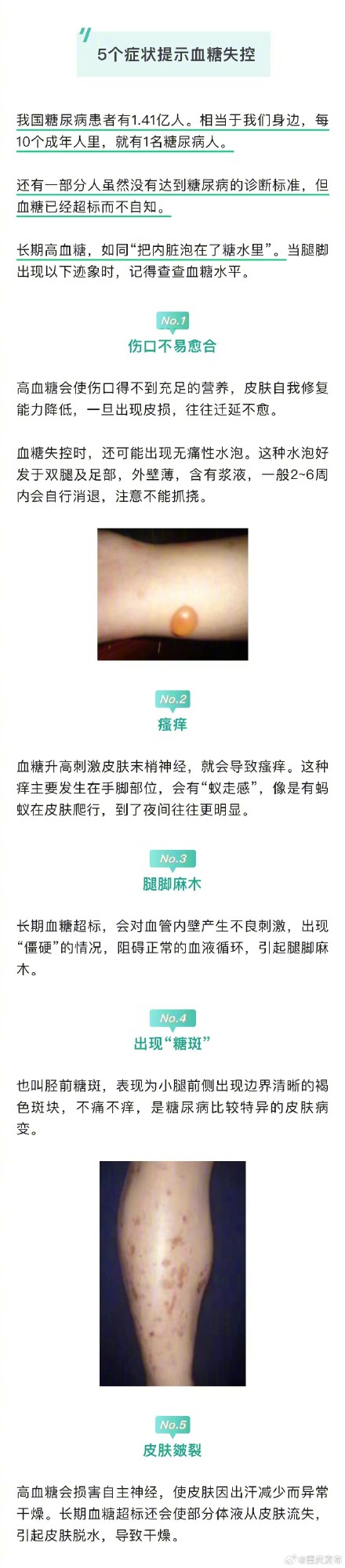 腿脚是人体自带的“血糖仪”