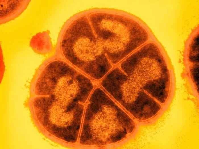 “细菌柯南”如何抵御极端辐射