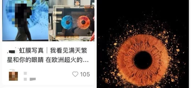 “虹膜写真”突然爆火!医生紧急提醒:有危险! “虹膜写真”突然爆火!医生紧急提醒:有危险!
