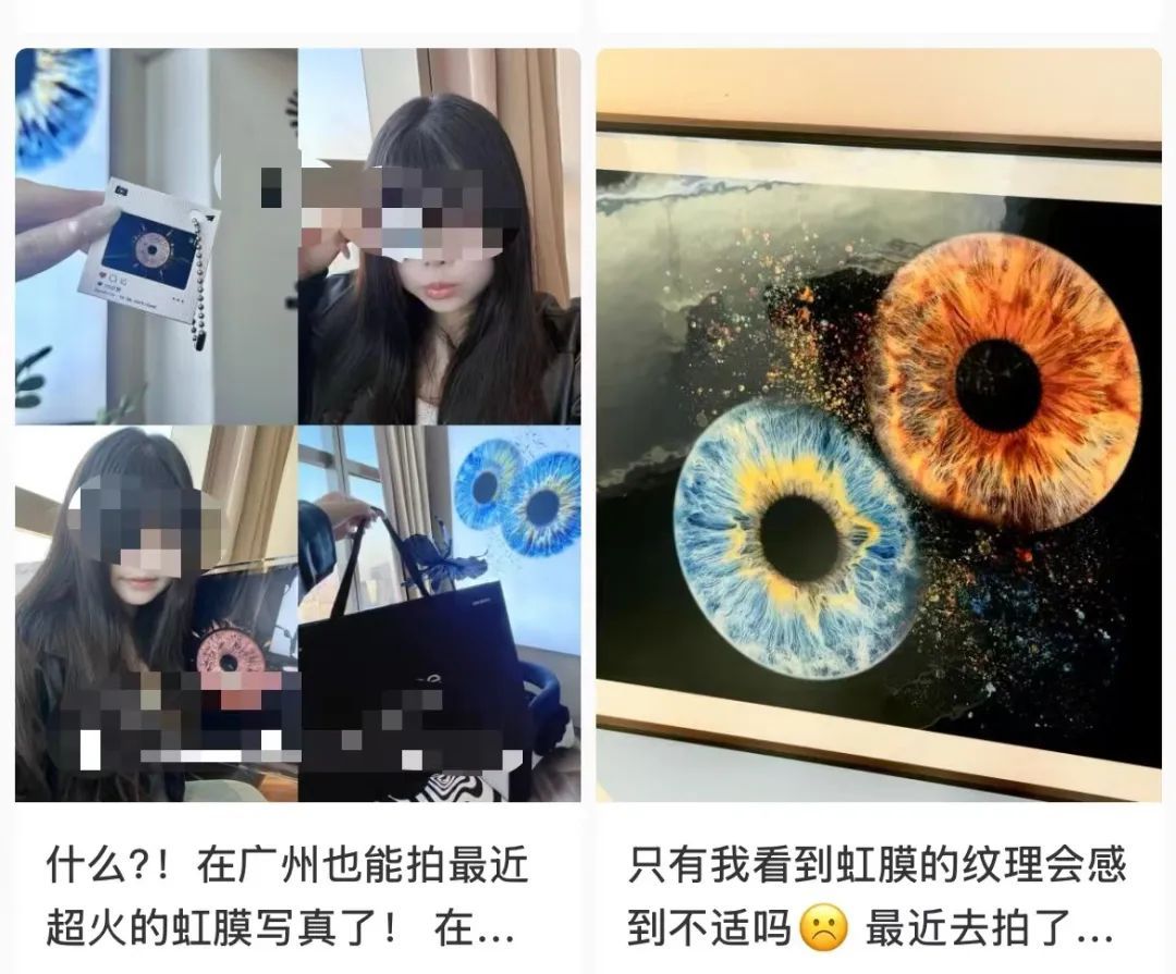 突然走红！有人开始给眼珠子拍写真，医生提醒
