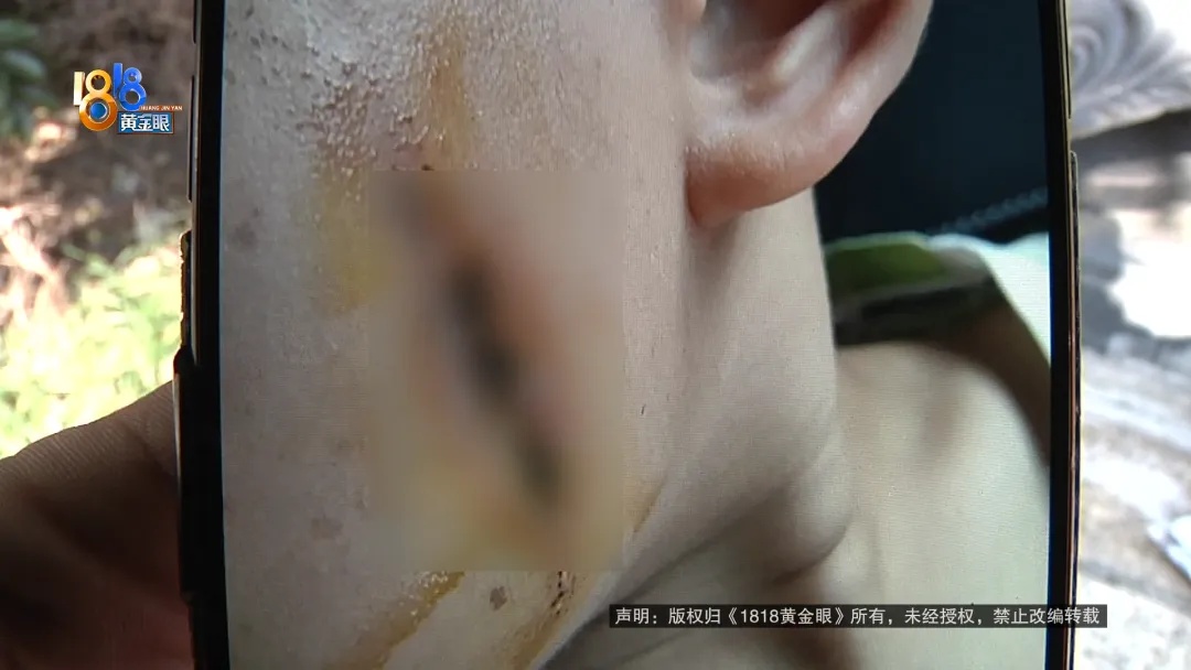 心疼！5岁男童触碰它后瞬间晕厥，这个东西街上常见…