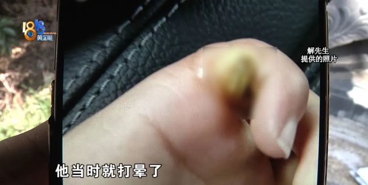 后怕！5岁男童瞬间晕厥，筋都断了……街上常见，看见立即远离