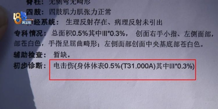 后怕！5岁男童瞬间晕厥，筋都断了……街上常见，看见立即远离