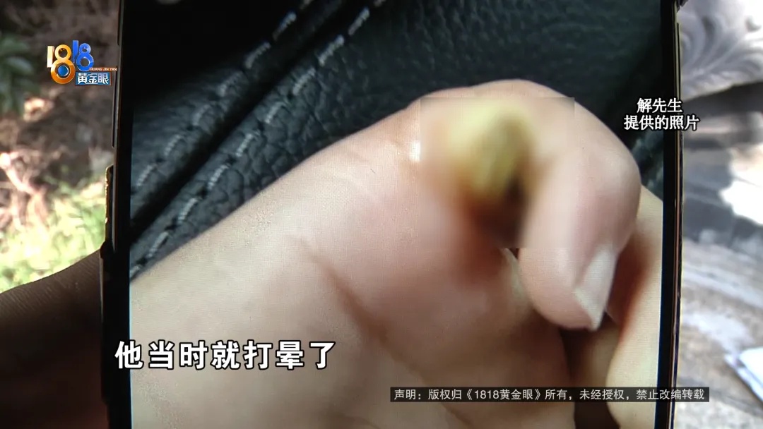 心疼！5岁男童触碰它后瞬间晕厥，这个东西街上常见…