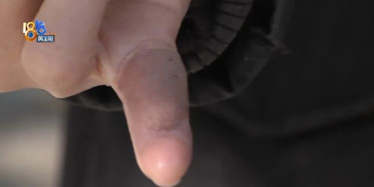 后怕！5岁男童瞬间晕厥，筋都断了……街上常见，看见立即远离