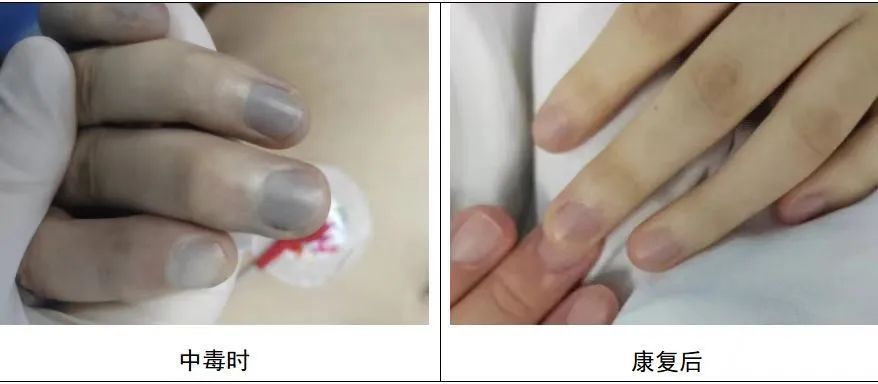 这类“下饭神器”可能暗藏中毒风险!很多人都爱吃,提醒→ 这类“下饭神器”可能暗藏中毒风险!很多人都爱吃,提醒→