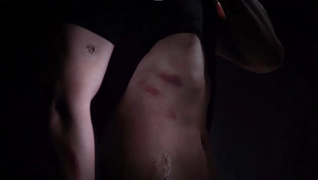 伤疤见证他的从警生涯!从辅警到缉毒警的12年,他“一路开挂”...... 伤疤见证他的从警生涯!从辅警到缉毒警的12年,他“一路开挂”......