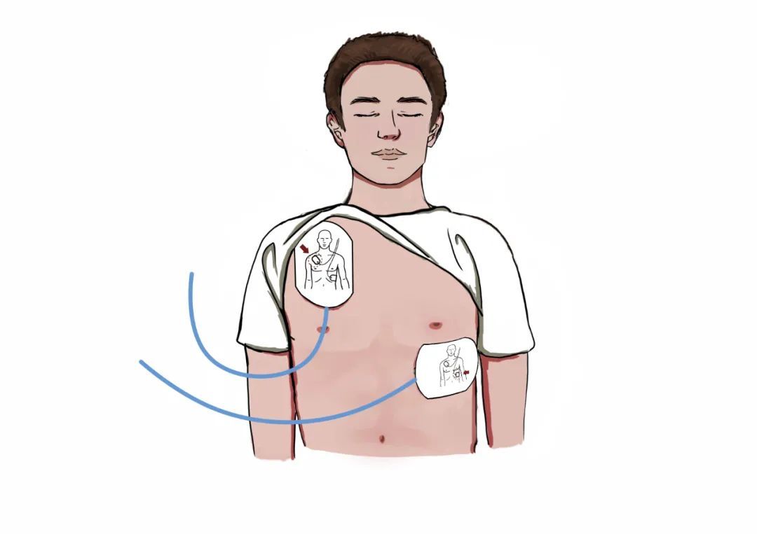 早高峰,上海一地铁站有人突然晕倒,命悬一线!工作人员紧急施救 早高峰,上海一地铁站有人突然晕倒,命悬一线!工作人员紧急施救