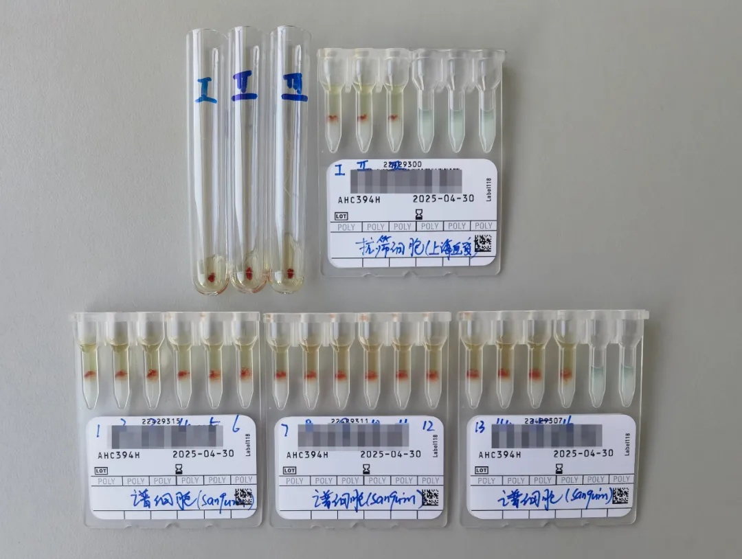 发现一例,极为罕见!医生:这类人早做准备 发现一例,极为罕见!医生:这类人早做准备