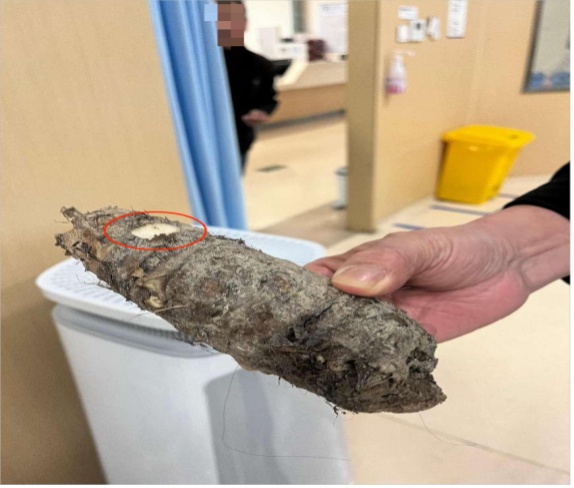 舔一口差点住进ICU！温州一女子错把滴水观音当芋头