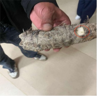 舔一口差点住进ICU！温州一女子错把滴水观音当芋头