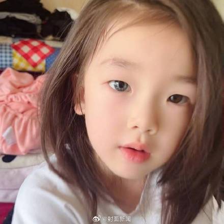 7岁女孩天生异瞳眼睛一蓝一棕 医生：不影响视力