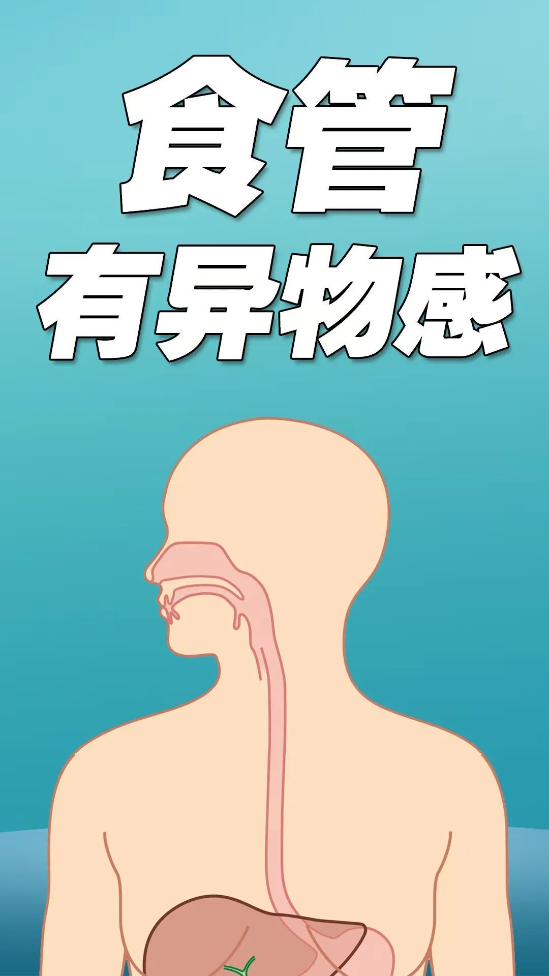 吃饭有这个习惯,食管癌风险倍增 吃饭有这个习惯,食管癌风险倍增