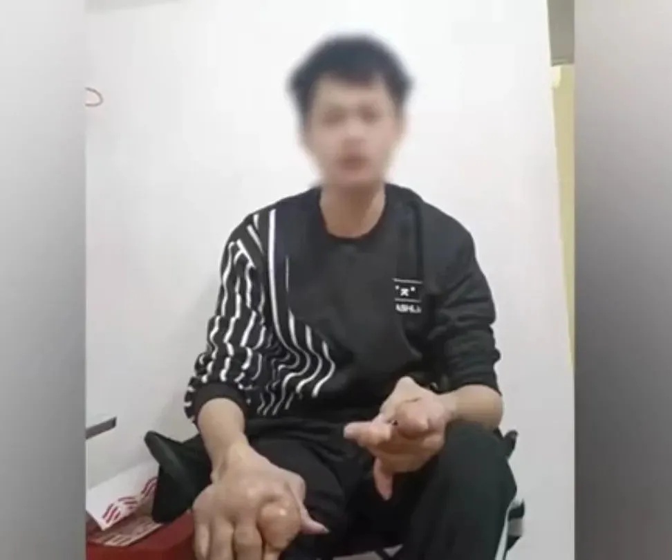 吓人！广东小伙双手密密麻麻长满“石头”，这个习惯很多人也有……