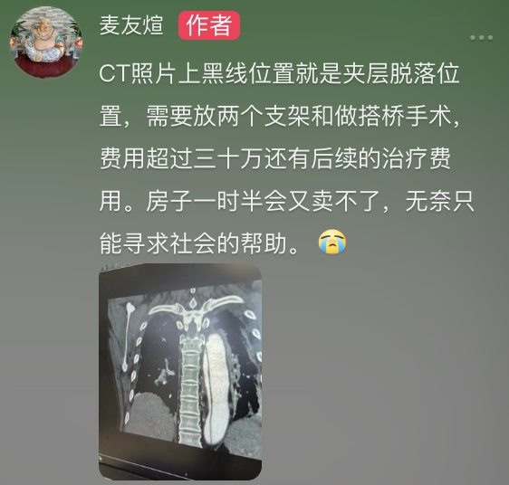 45岁网红吃宵夜晕倒，昏迷8个月后去世！这种病冬季高发，像人被撕裂！
