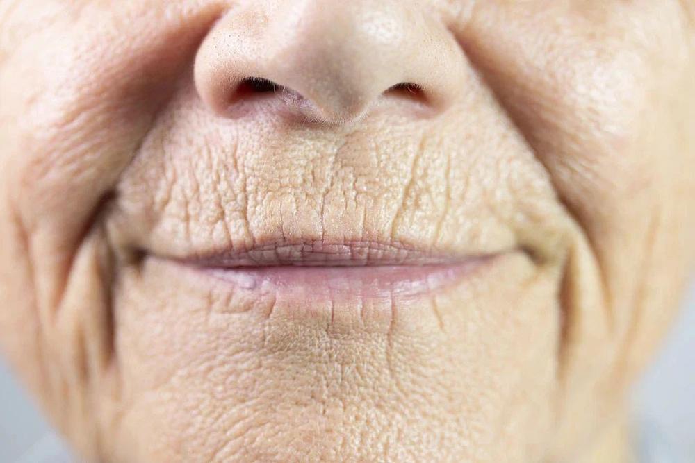 血管不好从脸上、腿上就能看出来 有这6个症状要警惕! 血管不好从脸上、腿上就能看出来 有这6个症状要警惕!