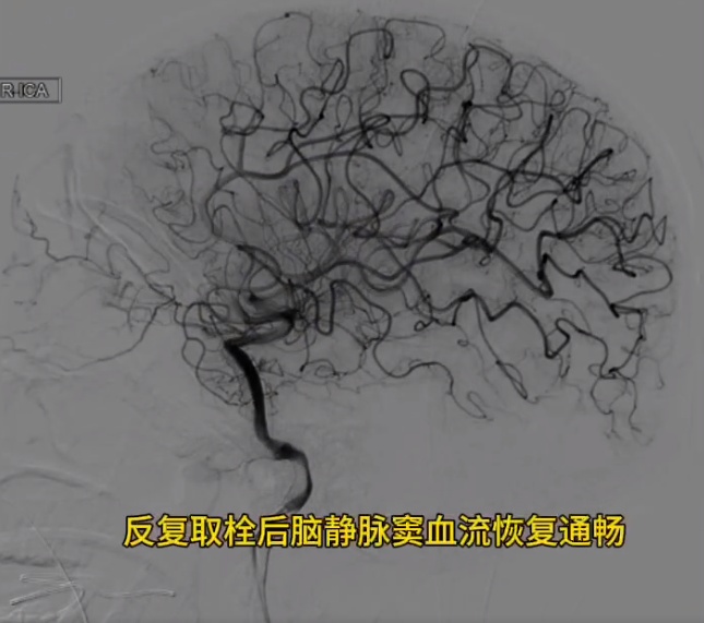 16岁女孩当街晕倒！医生：这习惯得改