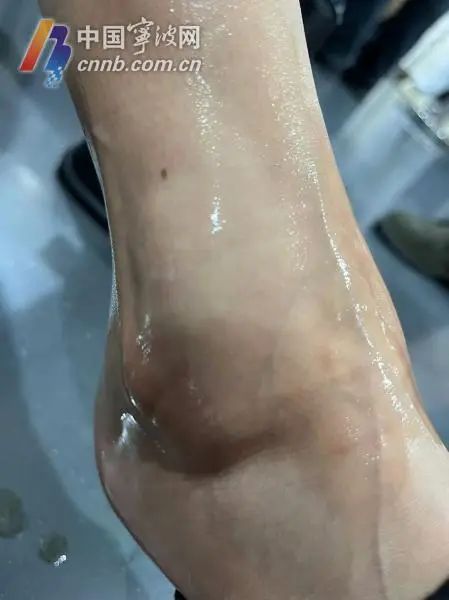 宁波一女子在山姆购物时意外摔倒骨折，商场要担责吗?