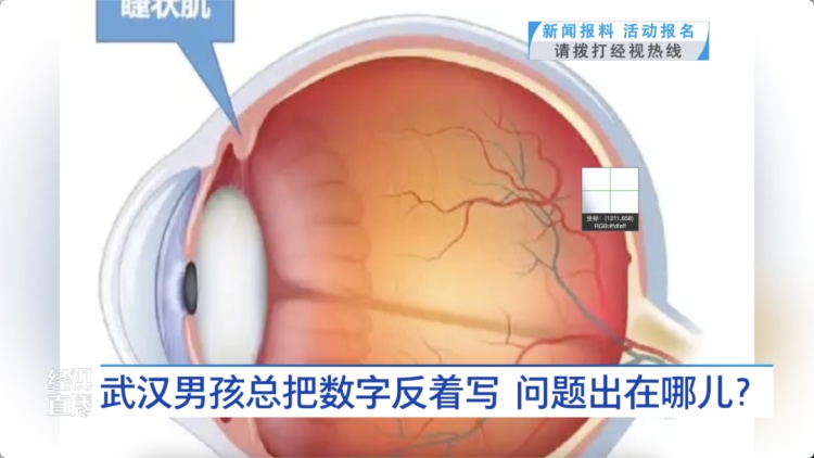 8岁男孩反着写数字……医生：这种孩子越来越多