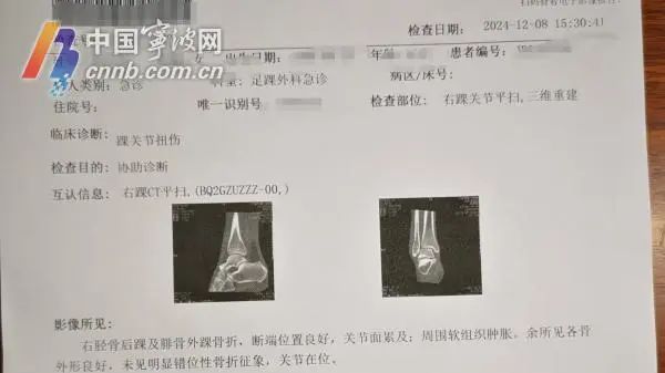 宁波一女子在山姆购物时意外摔倒骨折，商场要担责吗?
