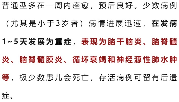 传染力强,发病急!紧急提醒 传染力强,发病急!紧急提醒