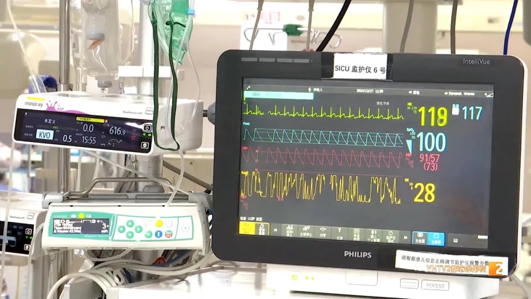 揪心!女童四根手指被刀切断 医生紧急救治 揪心!女童四根手指被刀切断 医生紧急救治