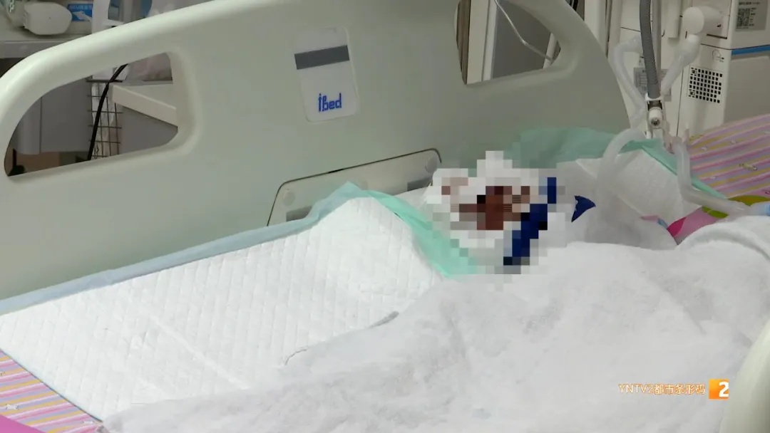 揪心!女童四根手指被刀切断 医生紧急救治 揪心!女童四根手指被刀切断 医生紧急救治