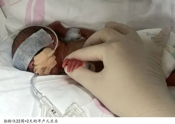 突破极限,刷新上海“最小”纪录! 突破极限,刷新上海“最小”纪录!