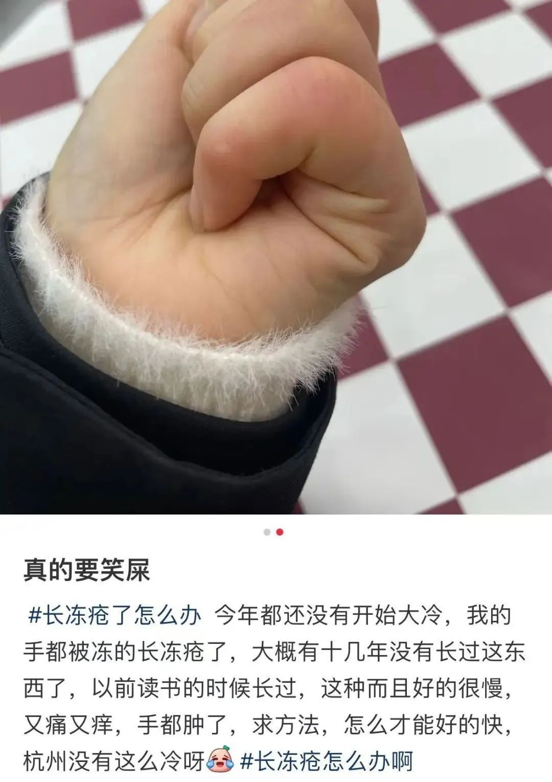 又痛又痒！最近不少人中招：太难受了，千万注意