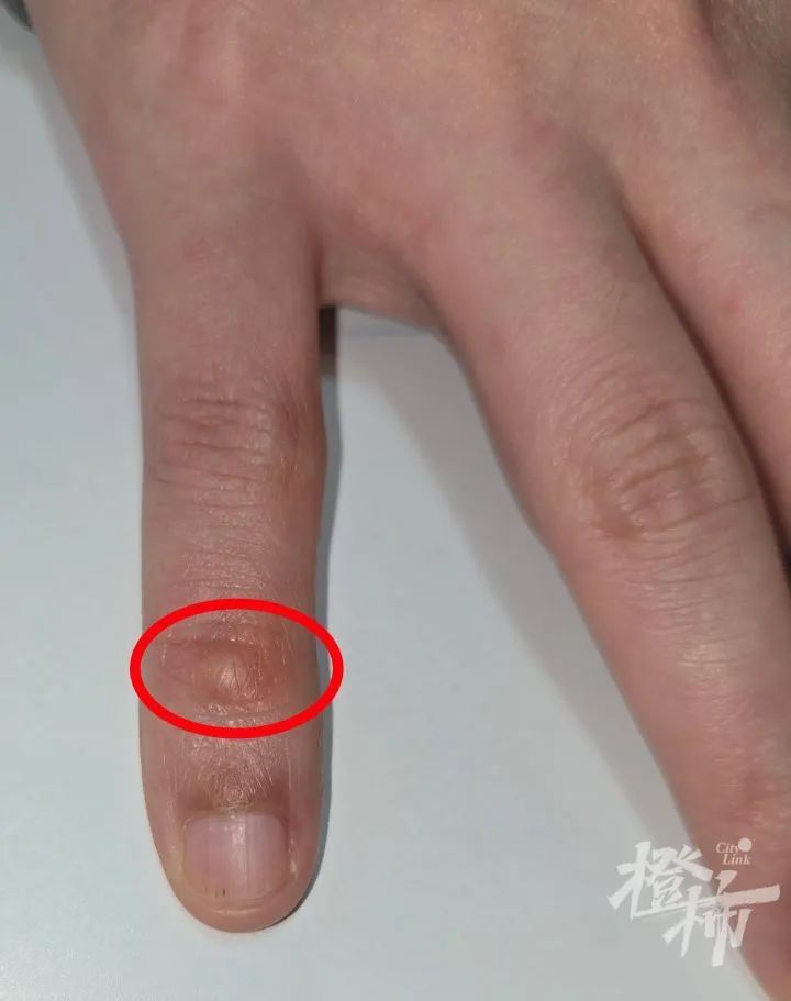 男子怀疑自己感染HPV,没想到竟跟手机有关!提醒:你可能正在做 男子怀疑自己感染HPV,没想到竟跟手机有关!提醒:你可能正在做