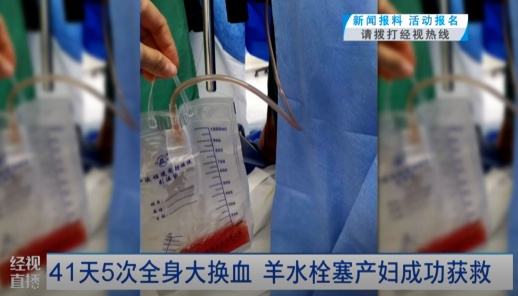 救回来了！41天5次全身大换血，羊水栓塞产妇成功获救