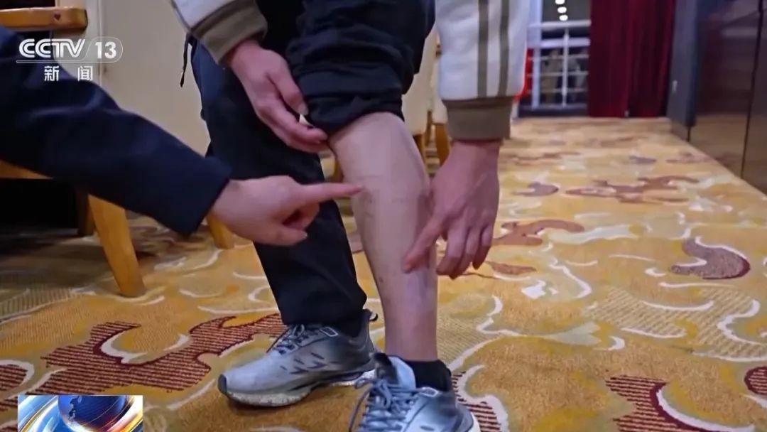 20岁的孩子，死在了缅北……