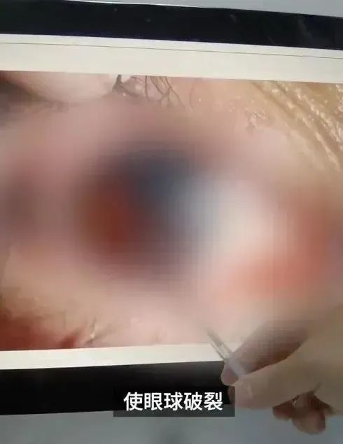 惊险！广东一男孩刚摇晃完就炸了，最近很多人用……