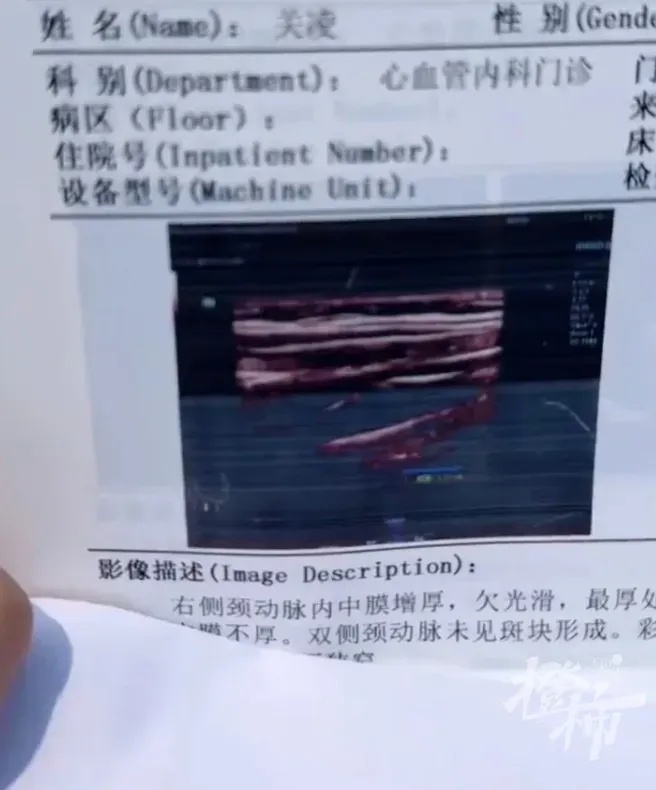 知名女演员，突然自曝！网友笑称：你也有今天