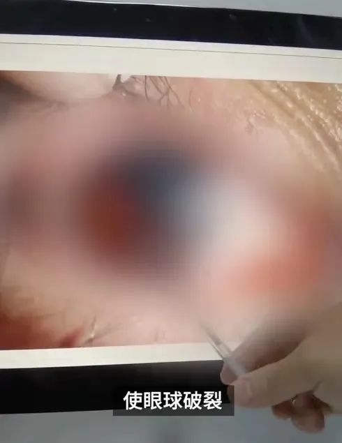 保温杯爆炸冲上热搜!这个广东男孩只是摇晃了几下 保温杯爆炸冲上热搜!这个广东男孩只是摇晃了几下