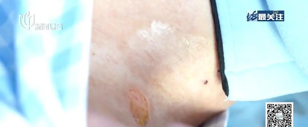 1月1日起进医保了!有患者激动哭了:原来1年要10万多... 1月1日起进医保了!有患者激动哭了:原来1年要10万多...