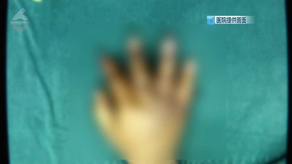 心疼!一岁半宝宝4根手指被切成7段,家里小孩的要注意了 心疼!一岁半宝宝4根手指被切成7段,家里小孩的要注意了