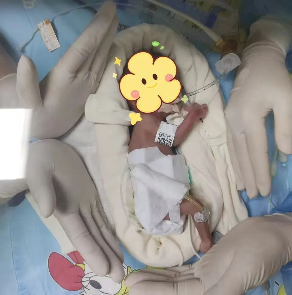 刷新海南纪录！出生时仅455克，海口“迷你宝宝”顺利出院
