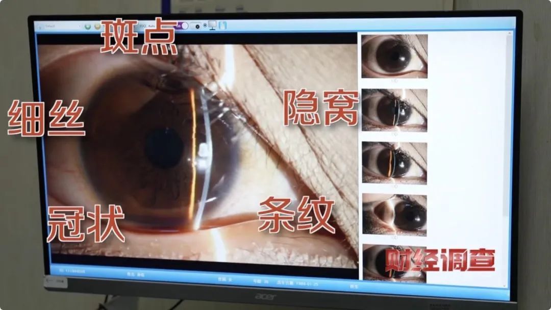 “虹膜写真”背后的惊人隐患,信息泄露只是冰山一角! “虹膜写真”背后的惊人隐患,信息泄露只是冰山一角!