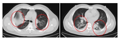 罕见！江苏确诊一例！