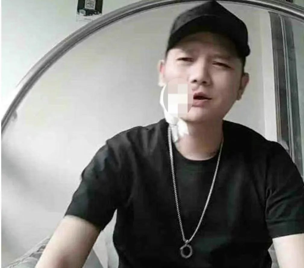 她已离世!曾手术割了半张脸 又是因为它 她已离世!曾手术割了半张脸 又是因为它