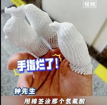 警惕！男子工作时用手拿棉签触碰氢氟酸，三根手指“烂出黑洞”