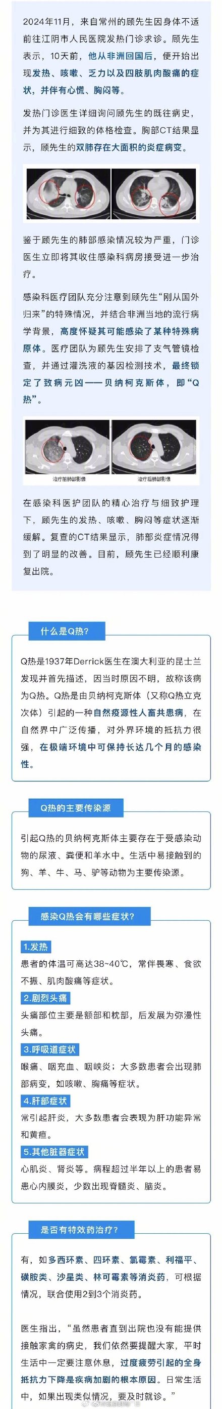 江苏确诊一例罕见传染病